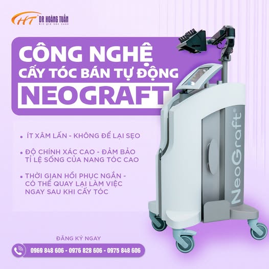 robot cấy tóc bán tự động neo graft